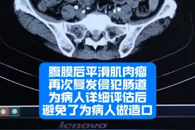 #腹膜后肿瘤 #腹膜后脂肪肉瘤 #腹膜后纤维化 #腹膜后平滑肌肉瘤 #硬核健康科普行动视频封面