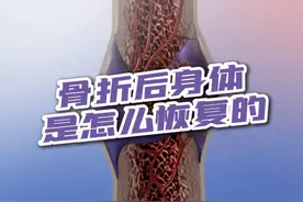 骨折后身体是怎么恢复的 #医学科普 #每天跟我涨知识 #骨折 #康复训练 #抖出健康知识宝藏视频封面