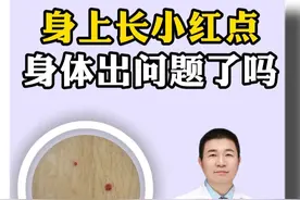 身上长小红点，是身体出问题了吗#樱桃状血管瘤 #红痣 #涨知识 #抖出健康知识宝藏