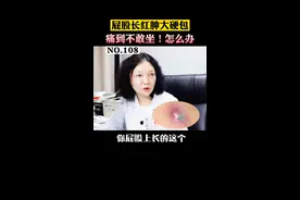 屁股上长了个红肿的硬硬的大包，非常痛，痛到连椅子都不敢唑，睡觉也不敢平躺睡！这可能是#火疖子  ！#诊室日常 #男性 #久坐 #健康 视频封面