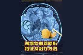 海绵状血管畸形特征和治疗方法 #硬核健康科普行动  #手术室日常 #海绵状血管畸形 #脑血管病 #宣武神外孙力泳视频封面