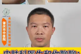皮肤科医生和你聊聊：出现了荨麻疹需要注意些什么？ 荨麻疹是皮肤科临床工作最常见的过敏性皮肤病之一，出现了荨麻疹的时候，有哪些简单的注意事项？今天我们来聊聊这个话题。
#医疗健康创作训练营 #硬核健康科普行动  #荨麻疹 #医学科普 @抖音短视频视频封面
