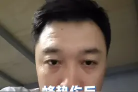 蜂蛰伤后，蜂刺千万别拔！#健康传播为人民 #蜂蛰伤 #蜜蜂蛰伤 #蜜蜂 #硬核健康科普行动视频封面