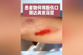 如何判断伤口是否到达真皮深层？ #医学科普 #伤口 #擦伤 #皮肤问题 #磕碰