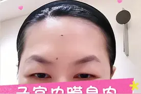 子宫内膜息肉，不是必须手术。 #子宫内膜息肉 #手术 #抖出健康知识宝藏  #健康无畏自在如她  #她们的精选视频封面