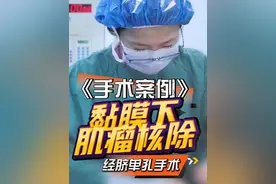 黏膜下肌瘤无疤痕手术 #子宫肌瘤 #黏膜下肌瘤 #微创手术 #单孔腹腔镜雷雨主任 #硬核健康科普行动视频封面