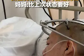 比上次状态好！8月16日，北京，“折叠男孩”姜延琛第二次手术结束，今天转入普通病房。延琛妈妈：他还想要安排冰镇可乐和冰激凌…#山东dou知道