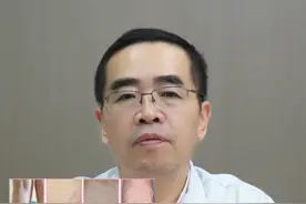 #中医 #健康 #静脉曲张视频封面