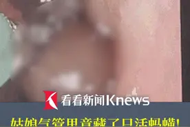 #姑娘气管里竟藏了只活蚂蟥 ！有喝溪水的习惯视频封面