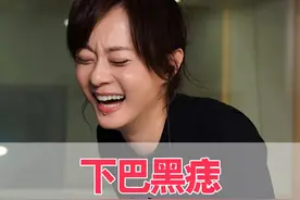 为何孙俪下巴上的“黑痣”越来越突出？一张高清照曝光，原来并非天生的这么简单#孙俪 #孙俪的痣 #甄嬛传 #娱乐评论大赏 #内容启发搜索视频封面