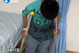 8月17日河南郑州：“大象腿”男孩奇奇第二期手术恢复良好，从站起来到走起来会越来越好#河南dou知道 视频封面