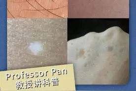皮肤出现小点，说明了哪些信号 #肝损伤的表现 ？#樱桃状血管瘤 #皮肤问题请找我 #硬核健康科普行动视频封面