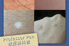 皮肤出现小点，说明了哪些信号 #肝损伤的表现 ？#樱桃状血管瘤 #皮肤问题请找我 #硬核健康科普行动视频封面