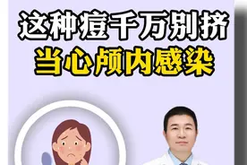 这种痘千万别挤，当心颅内感染#青春痘 #痤疮 #痘印 #医用痤疮防疤贴视频封面