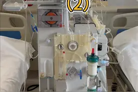 了解如何做血浆置换（2） #医疗设备 #医疗健康创作训练营视频封面
