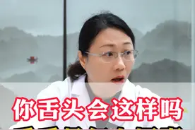 #中医 #脾胃 #湿气 #舌苔 #何婉婉医生视频封面