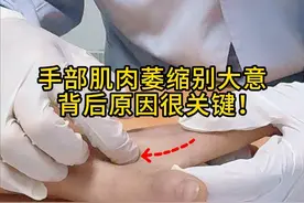 手部肌肉萎缩别大意  背后原因很关键！ #肌肉萎缩 #抖出健康知识宝藏  #开工去班味健康指南  #春季警惕这些高发疾病视频封面