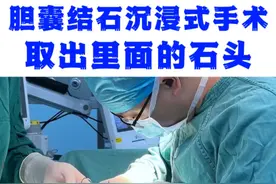 沉浸式胆囊手术 #胆囊结石 #胆结石 #手术室你不知道的事视频封面