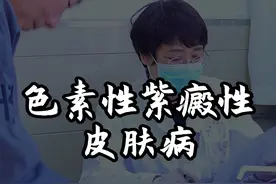 #过敏 #红斑 #医学科普 #皮肤病视频封面