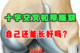 十字交叉韧带撕裂还能自己长好吗？答案是肯定的！对于大部分十字交叉韧带撕裂来说都是可以长好的，但是为什么你的十字交叉韧带受伤，伤后还一直都好不了，甚至走路时膝盖是经常传来疼痛感。#膝关节 #膝盖保养 #运动康复 #十字交叉韧带 #运动损伤视频封面