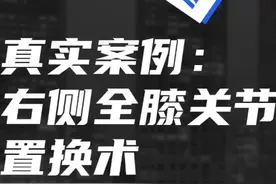 右膝置换手术全过程揭秘！术后多久能正常行走？👀视频封面