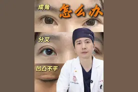 双眼皮术后线条不流畅，这些问题怎么办？
#医学科普 #科普医生 #诊室日常 #自然双眼皮 #线条不流畅视频封面