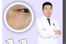 收藏3只非激素药膏，帮你对付脸上的斑斑点点#长斑 #痘痘 #不含激素 #痘印 #夏天变美