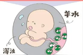 怀孕 #孕39周 出现#羊水浑浊 怎么办？一种情况属于正常，一种情况必须终止。#接一切好孕视频封面