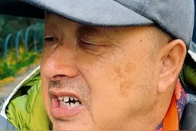 熬夜+喝酒，后果很严重！北京脑梗大爷现身说法，如何好转有方法视频封面