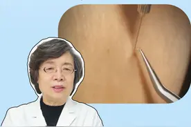 #脖子上长小肉粒 要当心！这是#病毒感染 ，小心传染给家人#丝状疣 #硬核健康科普行动  #夫妻视频封面