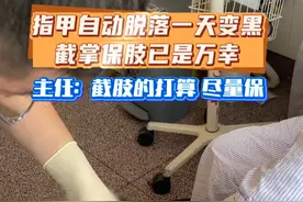 糖尿病足：清创截掉前半截坏死的脚掌只是第一步 情况继续好下去再植皮，植皮活了才算看到这阶段的胜利曙光！#糖尿病足 #糖尿病足护理视频封面