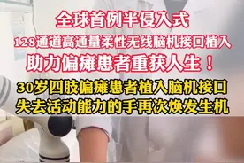 全球首例！振奋人心！ 当看到偏瘫患者喝到水的那一刻，我可能比现场任何人都激动！#脑机接口 #高位截瘫小伙实现“意念喝水” #高位截瘫 #北大一院伊志强医生 #抖出健康知识宝藏  @抖音医疗健康小助手视频封面