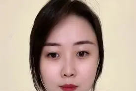 红眼病是通过什么被感染的？ #医学科普仅供参考如有不适请线下就医  #科普一下  #医疗小常识  #科普医生  #经验分享视频封面