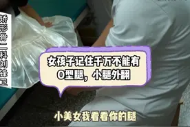 女孩子记住千万不能有O型腿，小腿外翻#O型腿 #小腿外翻视频封面