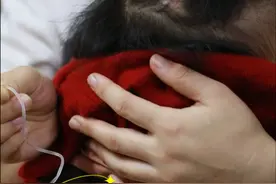 黑痣上面长毛更容易恶变吗？#黑痣 #黑毛痣 #硬核健康科普行动  #黑痣上面长毛好不好 #刘新海医生视频封面