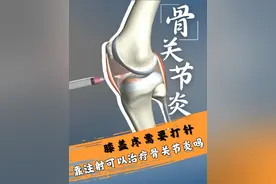 靠注射可以治疗骨关节炎吗？ #抖出健康知识宝藏 #开工去班味健康指南  #骨关节炎 #保膝医生贾俊秀 #内容启发搜索视频封面