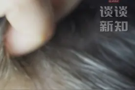 #头发白了一截还能变黑吗  #发梢或中间一截变白了还能变黑吗  发梢白或头发中间变白，可能是压力减轻让已经出现的白头发又黑回去了 #谈谈新知视频封面