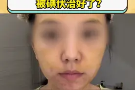 碘伏能祛痘？医生：有作用，但不多#医学科普 #皮肤 #痘痘 #碘伏 #正确护肤视频封面