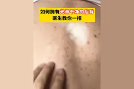 前胸后背长很痒的小疙瘩，别再挠了，这可能是#马拉色菌毛囊炎 ，要对症处理。#前胸后背痘#毛囊炎#痒#痘痘视频封面