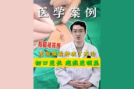 皮脂腺囊肿破了再治，切口更长、疤痕更明显 #皮脂腺囊肿 #粉瘤切除 #北医三院张辰博士