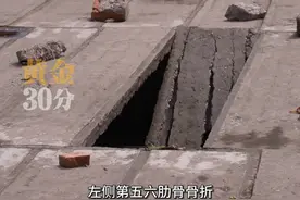 3月24日晚上，南充市营山县两女子饭后散步，途径一桥面时，桥面断裂，两女子坠入近5米深的河床，受伤严重面临瘫痪风险。#桥 #断裂 #危险瞬间视频封面