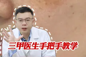 “斑中之王”#黄褐斑 ，别乱花钱走弯路！医生教你用对方法好处理！#淡斑 #祛斑 #抖出健康知识宝藏#护肤