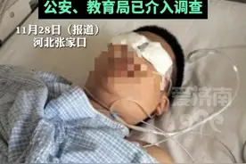 小学生被班主任殴打后失明？当地教育局回应#教育 #老师和学生 #社会百态 #热点新闻事件 #热门推荐视频封面