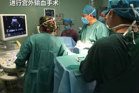 山东省立医院实施6次宫内输血手术成功救治一例重度贫血胎儿视频封面