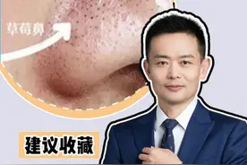 草莓鼻不用愁，手把手教你清黑头！ #黑头 #皮肤病 #医学科普 #硬核健康科普行动视频封面