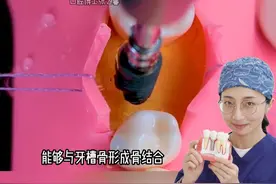 种植牙植入过程是什么样的？跟着博士一起来看看吧~
#种植牙 #牙医日常 #口腔科普 #看牙医视频封面