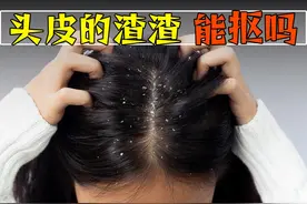 头皮上抠下来的渣渣具体是什么，到底能不能抠？视频封面