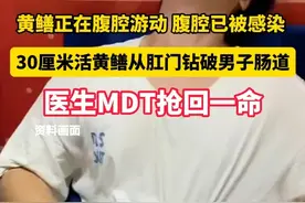 黄鳝正在腹腔游动 腹腔已被感染 30厘米活黄鳝从肛门钻破男子肠道 医生MDT抢回一命