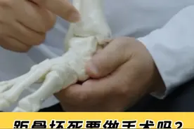 距骨坏死，走路越多可能会越严重，需要手术吗？要看这一点 #医学科普 
当距骨骨软骨损伤发生后，患者往往会感到脚踝疼痛、肿胀，尤其是走路时间比较久了，疼痛会更明显。疾病发展到后期，休息时也会感到疼痛。
通常X线检查无法显示软骨损伤，因此还需要做MRI检查。MRI可以更准确地显示出关节软骨、软骨下骨、纤维软骨，关节液和肉芽组织，通过核磁可以准确判断损伤的范围和程度，为治疗提供重要依据。视频封面
