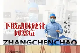 下肢动脉硬化闭塞症的症状表现#下肢动脉硬化闭塞症 #腿痛腿抽筋 #静息痛 #血管外科张成超 #硬核健康科普行动视频封面